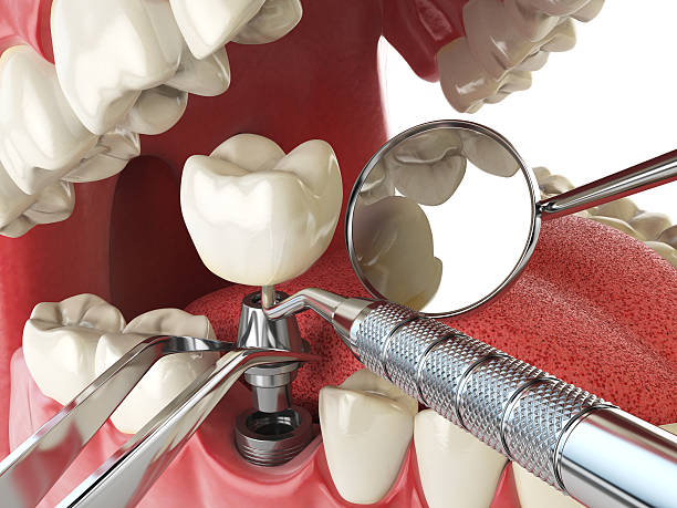 Trusted UT Emergency Dental Service Experts